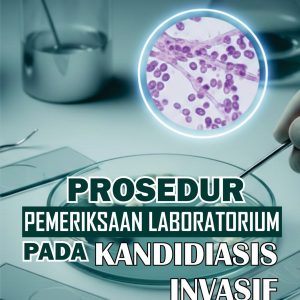 Prosedur Pemeriksaan Laboratorium pada Kandidiasis Invasif